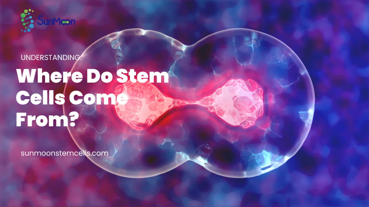 Stem Cell Therapy